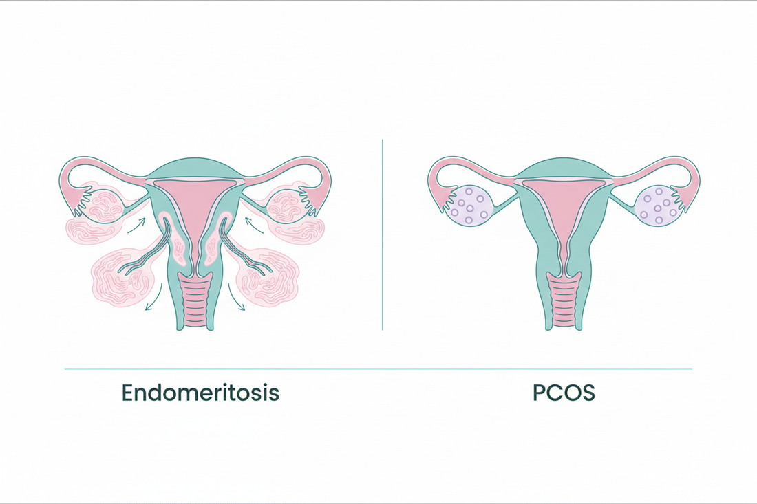 can you have endometriosis and pcos